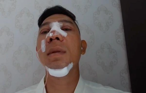 Đập mặt đi xây lại bạn trai thánh nữ ngực đẹp khiến mẹ đẻ cũng chẳng nhận ra - 3