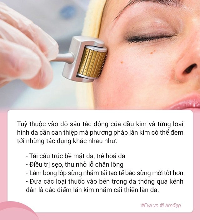 Để không gặp biến chứng hậu lăn kim chị em lưu ngay những lời khuyên của bác sĩ da liễu - 3