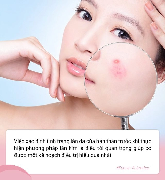 Để không gặp biến chứng hậu lăn kim chị em lưu ngay những lời khuyên của bác sĩ da liễu - 5
