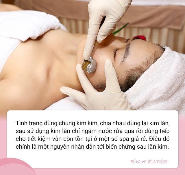 Để không gặp biến chứng hậu lăn kim chị em lưu ngay những lời khuyên của bác sĩ da liễu - 6