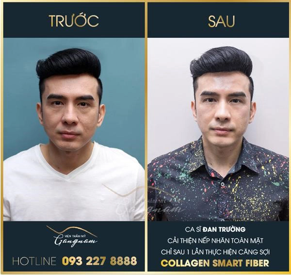 Điểm mặt những nghệ sĩ là khách ruột của viện thẩm mỹ mega gangnam - 4