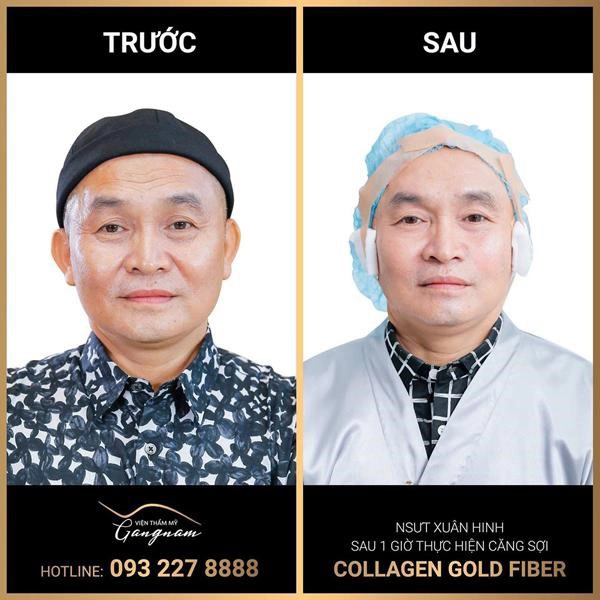 Điểm mặt những nghệ sĩ là khách ruột của viện thẩm mỹ mega gangnam - 5