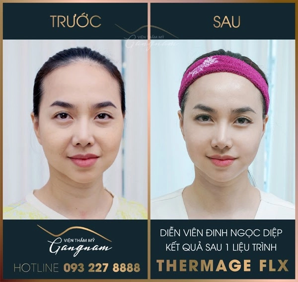 Điểm mặt những nghệ sĩ là khách ruột của viện thẩm mỹ mega gangnam - 6