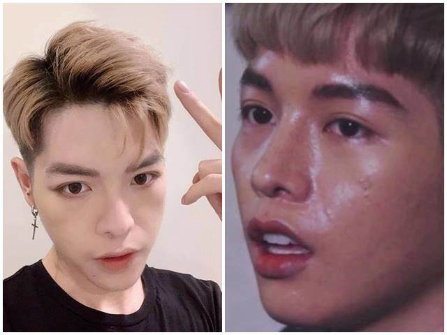 Đức phúc lương bằng quang dao kéo nát mặt nhưng vẫn thua xa mỹ nam phẫu thuật 20 lần này - 14