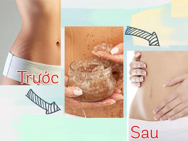 Đừng bỏ qua những sản phẩm trị rạn da thần kỳ chỉ từ 180 nghìn đồng này - 10