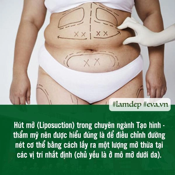 Giảm cân thần kỳ bằng phương pháp hút mỡ liệu trên đời thực sự có phép màu đó - 2