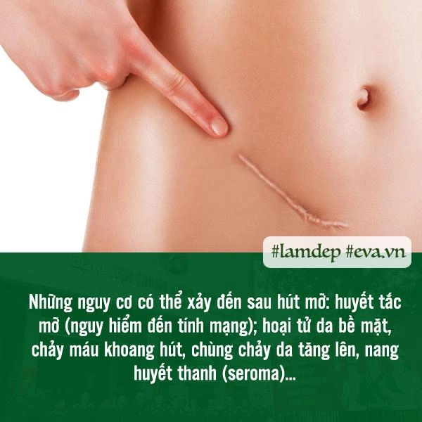 Giảm cân thần kỳ bằng phương pháp hút mỡ liệu trên đời thực sự có phép màu đó - 4