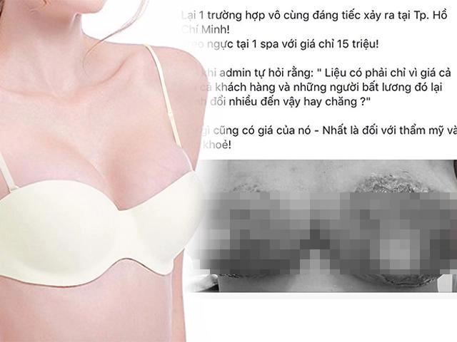 Giảm cân thần kỳ bằng phương pháp hút mỡ liệu trên đời thực sự có phép màu đó - 7