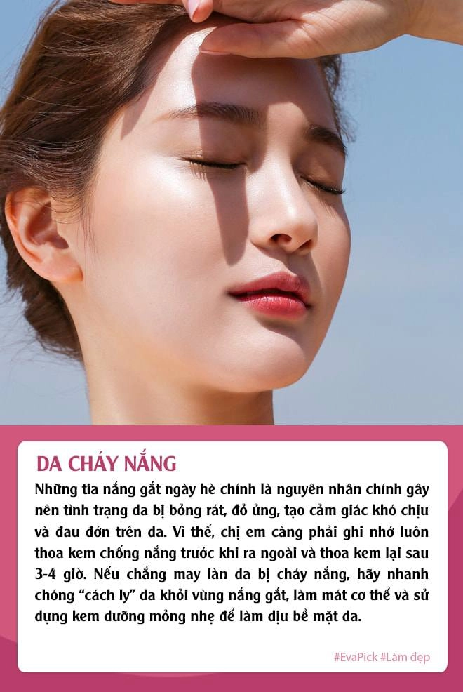Hè đến mang theo loạt bệnh về da chị em đừng quên những bí kíp chăm sóc da hiệu quả - 2