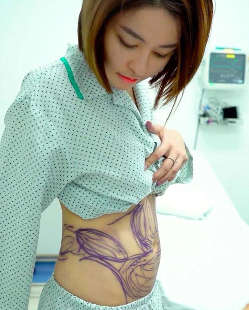 Hotgirl trâm anh tự nhận đập đi xây lại khuôn mặt nhưng sự thậtchỉ thay đổi điểm này - 2