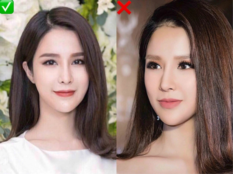 Hotgirl trâm anh tự nhận đập đi xây lại khuôn mặt nhưng sự thậtchỉ thay đổi điểm này - 15