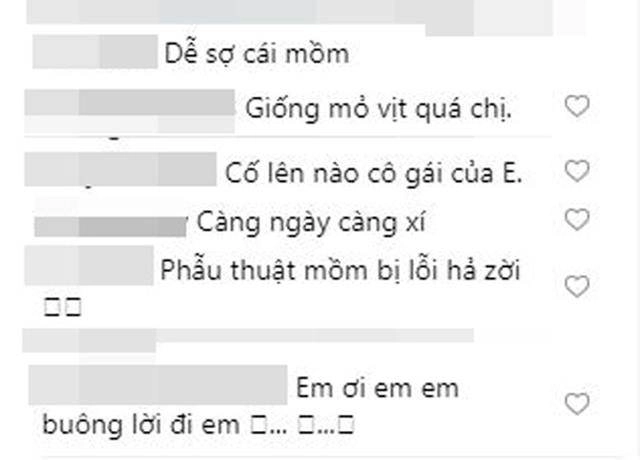 Khoe ảnh đẹp nhưng bị chê môi tều như mỏ vịt linh chi lập tức đáp trả gay gắt - 2