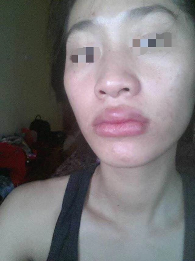 Khoe ảnh đẹp nhưng bị chê môi tều như mỏ vịt linh chi lập tức đáp trả gay gắt - 13