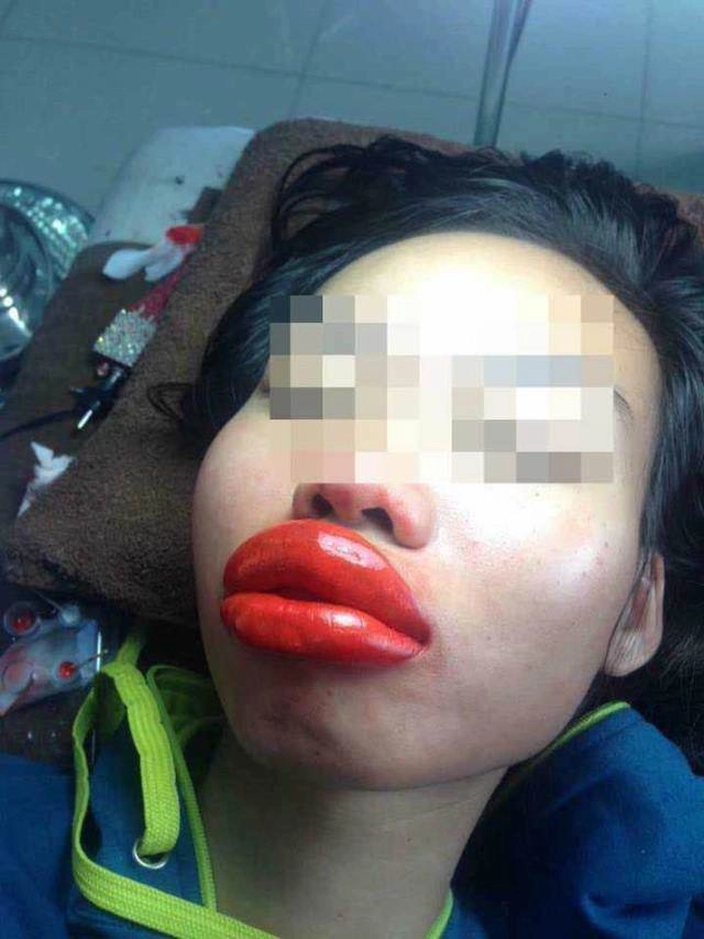 Khoe ảnh đẹp nhưng bị chê môi tều như mỏ vịt linh chi lập tức đáp trả gay gắt - 15