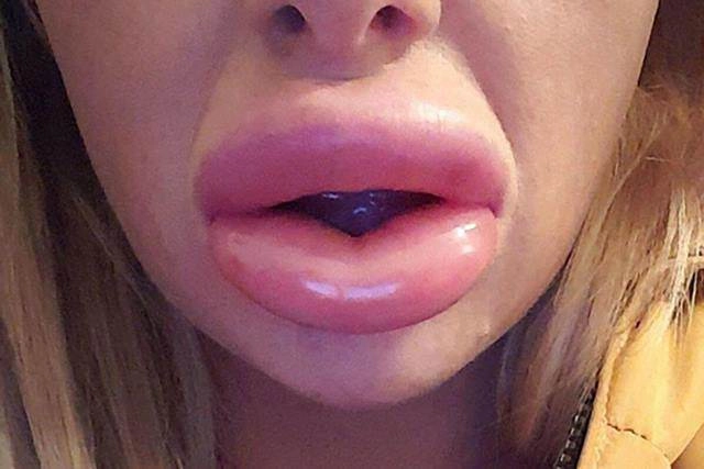 Khoe ảnh đẹp nhưng bị chê môi tều như mỏ vịt linh chi lập tức đáp trả gay gắt - 16