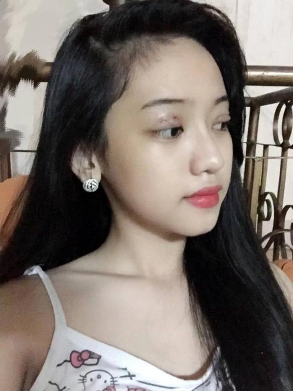 Khoe thầy bói phán tướng tốt thúy vi bị mỉa mai sửa hết rồi mà vẫn coi mặt được à - 8