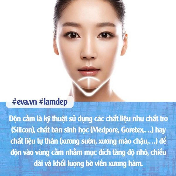 Không muốn hối hận sau chỉnh sửa vùng cằm chị em nhất định phải biết điều này - 5