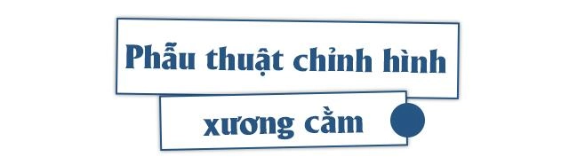 Không muốn hối hận sau chỉnh sửa vùng cằm chị em nhất định phải biết điều này - 6