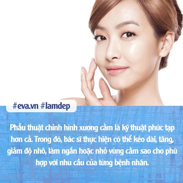 Không muốn hối hận sau chỉnh sửa vùng cằm chị em nhất định phải biết điều này - 7
