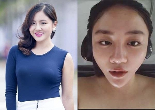 Kỳ duyên và hội những mỹ nhân nhan sắc thay đổi chóng mặt vẫn khẳng định 100 tự nhiên - 10