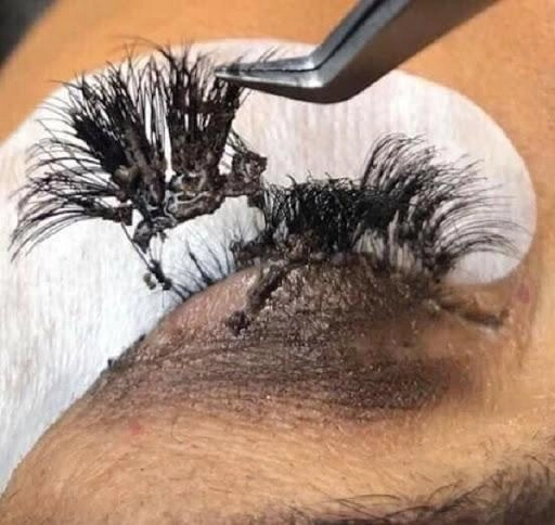 Loạt ảnh rợn cả người khiến chị em rùng mình xem xong còn ai dám đi nối mi - 2