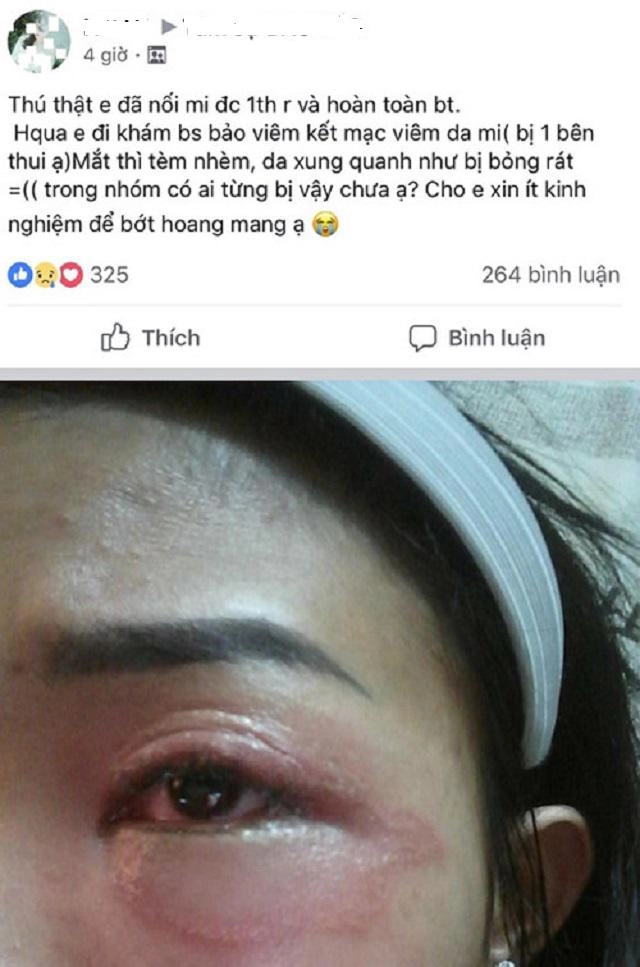 Loạt ảnh rợn cả người khiến chị em rùng mình xem xong còn ai dám đi nối mi - 5