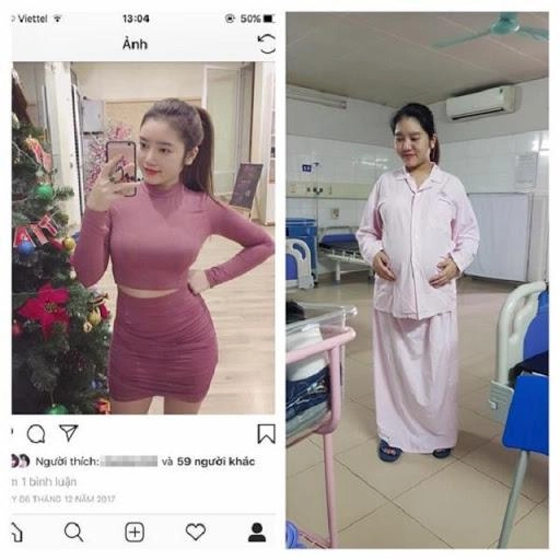 Loạt ảnh trước và sau khi đẻ chứng minh phụ nữ nào cũng từng có 1 thanh xuân rực rỡ - 2