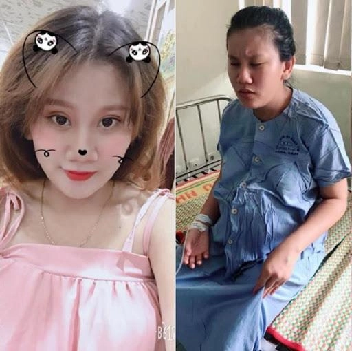 Loạt ảnh trước và sau khi đẻ chứng minh phụ nữ nào cũng từng có 1 thanh xuân rực rỡ - 7