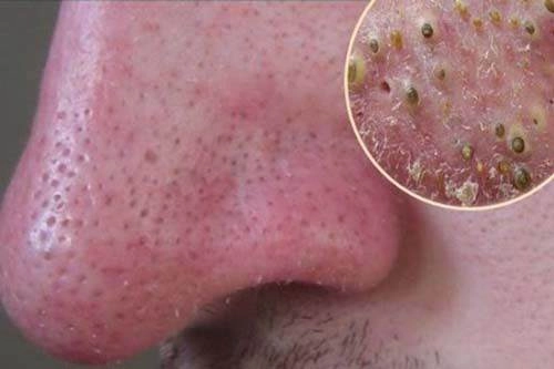 Luộc trứng gà lên lăn qua lăn lại trên mặt và chờ xem điều bất ngờ gì xảy ra - 6
