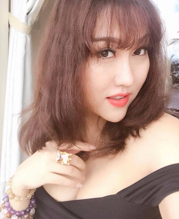 Mũi biến dạng cằm lệch một bên phi thanh vân đối diện với biến chứng sau nhiều lần dao kéo - 3