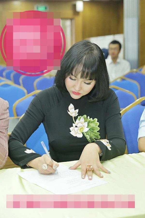 Mũi biến dạng cằm lệch một bên phi thanh vân đối diện với biến chứng sau nhiều lần dao kéo - 7
