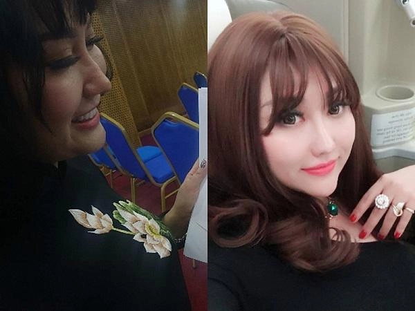 Mũi biến dạng cằm lệch một bên phi thanh vân đối diện với biến chứng sau nhiều lần dao kéo - 9