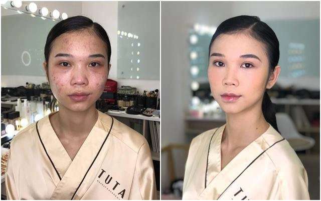 Mụn chi chít cỡ nào cũng biến mất chỉ nhờ 5 phút áp dụng cách trang điểm cực dễ này - 9
