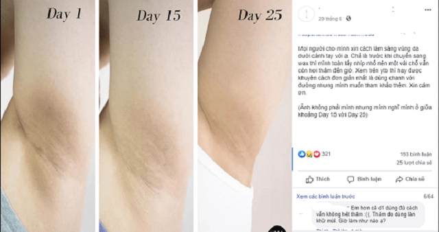 Ngoài vi-o-long da dưới vùng nách đen sạm sần sùi là do bạn chưa biết những điều này - 2