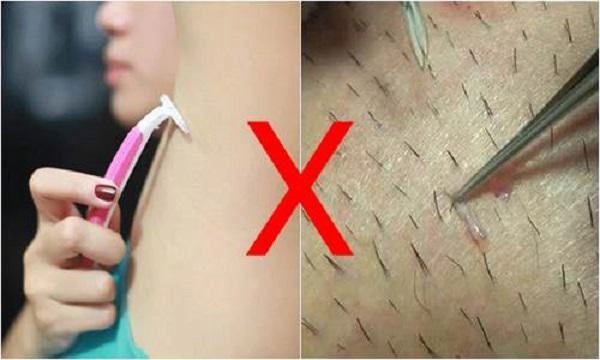 Ngoài vi-o-long da dưới vùng nách đen sạm sần sùi là do bạn chưa biết những điều này - 3