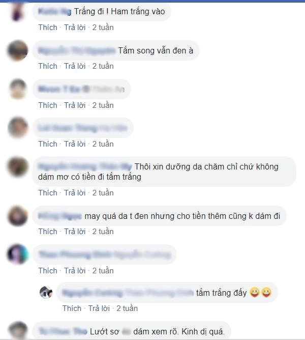 Người nổi đầy gân xanh như trong phim kinh dị tất cả là bởi phương pháp làm đẹp này - 7