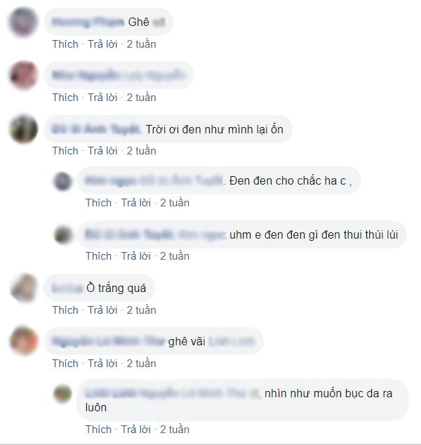 Người nổi đầy gân xanh như trong phim kinh dị tất cả là bởi phương pháp làm đẹp này - 8