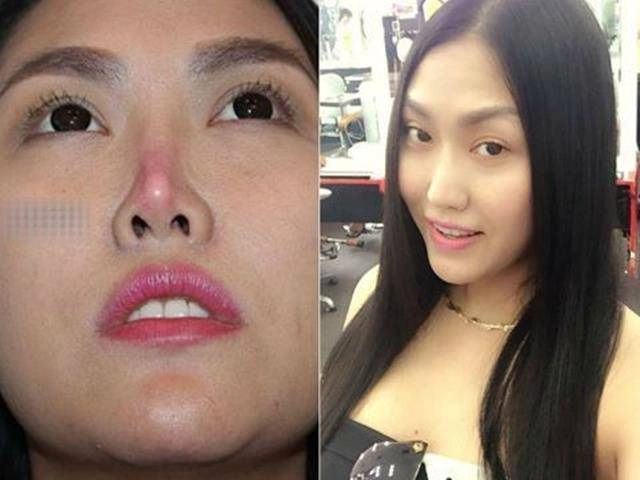 Nhìn ảnh quá khứ giá như phi thanh vân và những mỹ nhân này đừng phẫu thuật thẩm mỹ - 2