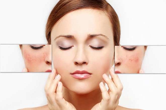 Nhờ bí quyết từ thiên nhiên - thoát kiếp da yếu tổn thương do làm đẹp sai cách - 1
