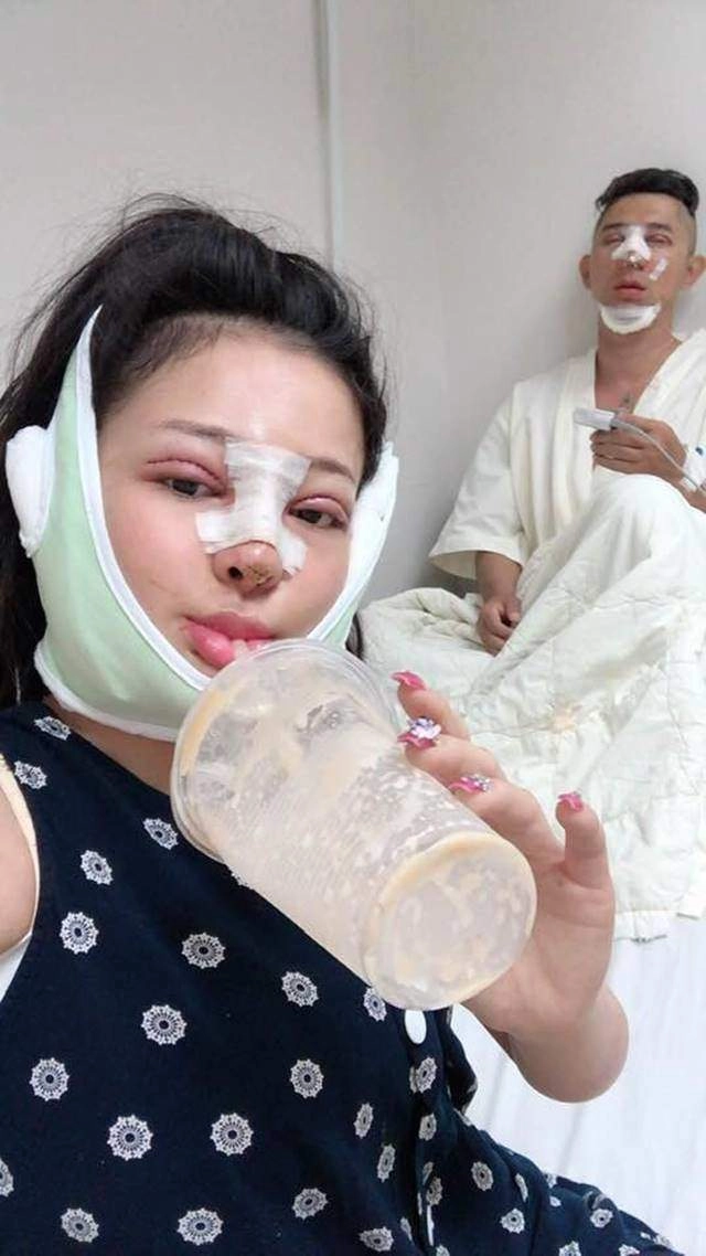 Nối gót lương bằng quang - ngân 98 vợ chồng nam chính gạo nếp gạo tẻ cùng đi dao kéo - 3