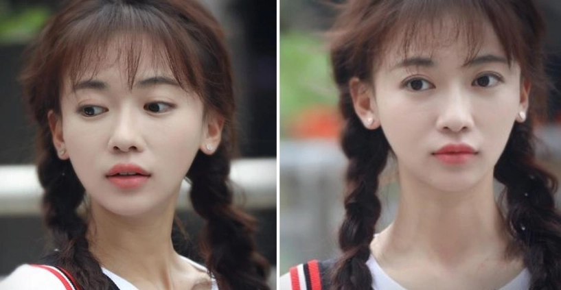 Nổi tiếng chưa lâu ngụy anh lạc bị tố độn cằm lộ ảnh quá khứ khác xa hiện tại - 1