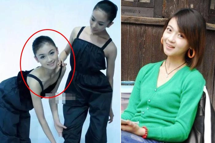 Nổi tiếng chưa lâu ngụy anh lạc bị tố độn cằm lộ ảnh quá khứ khác xa hiện tại - 2