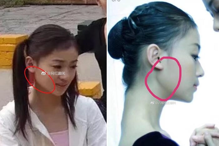 Nổi tiếng chưa lâu ngụy anh lạc bị tố độn cằm lộ ảnh quá khứ khác xa hiện tại - 3