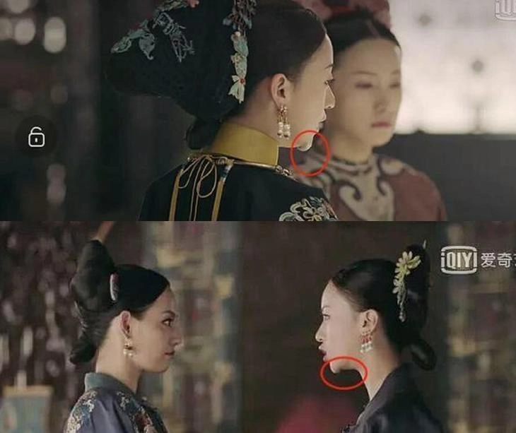Nổi tiếng chưa lâu ngụy anh lạc bị tố độn cằm lộ ảnh quá khứ khác xa hiện tại - 5