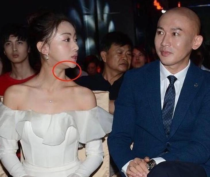 Nổi tiếng chưa lâu ngụy anh lạc bị tố độn cằm lộ ảnh quá khứ khác xa hiện tại - 7