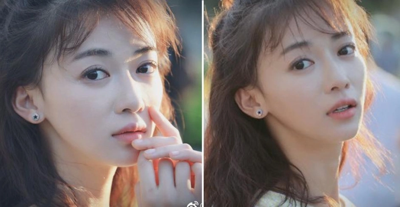 Nổi tiếng chưa lâu ngụy anh lạc bị tố độn cằm lộ ảnh quá khứ khác xa hiện tại - 10