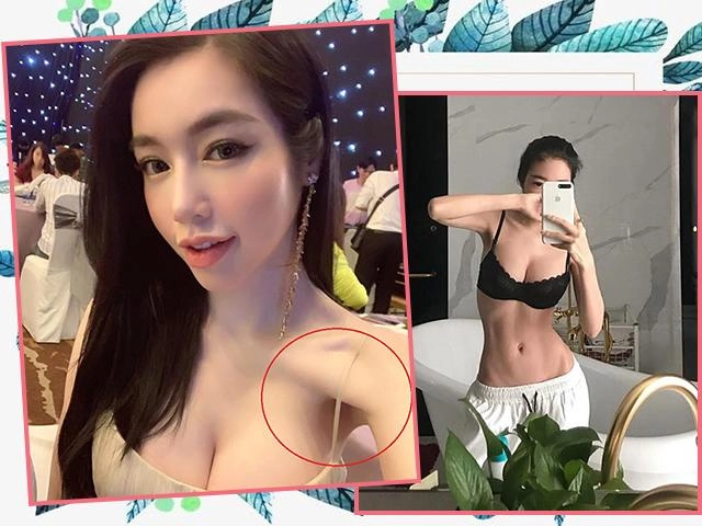 Nổi tiếng chưa lâu ngụy anh lạc bị tố độn cằm lộ ảnh quá khứ khác xa hiện tại - 11