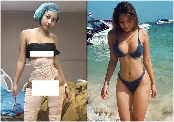 Nổi tiếng với sắc vóc đẹp như mơ hotgirl thái lan gây sốc khi công khai dao kéo toàn thân - 1