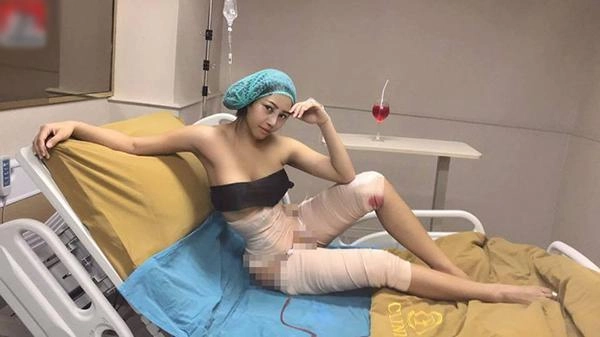 Nổi tiếng với sắc vóc đẹp như mơ hotgirl thái lan gây sốc khi công khai dao kéo toàn thân - 2