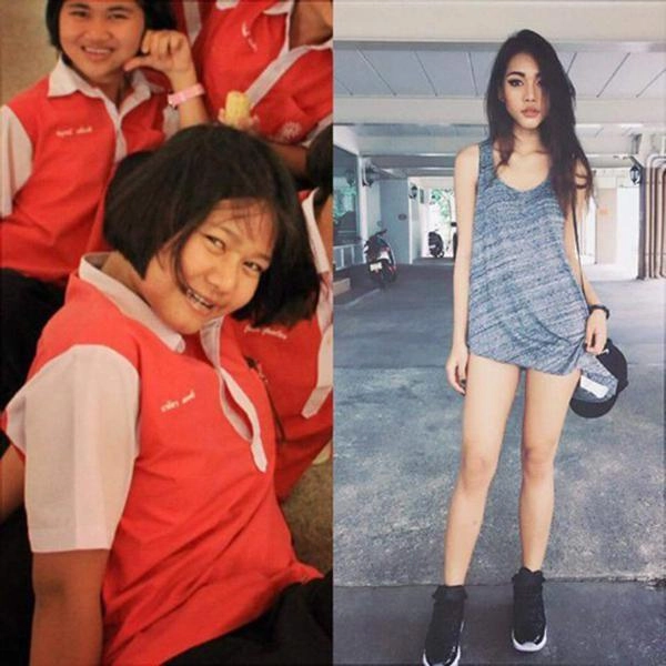 Nổi tiếng với sắc vóc đẹp như mơ hotgirl thái lan gây sốc khi công khai dao kéo toàn thân - 3